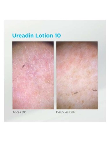 Isdin Ureadin 10 Lotion Hidratación Intensa Piel Seca, 1000 Ml
