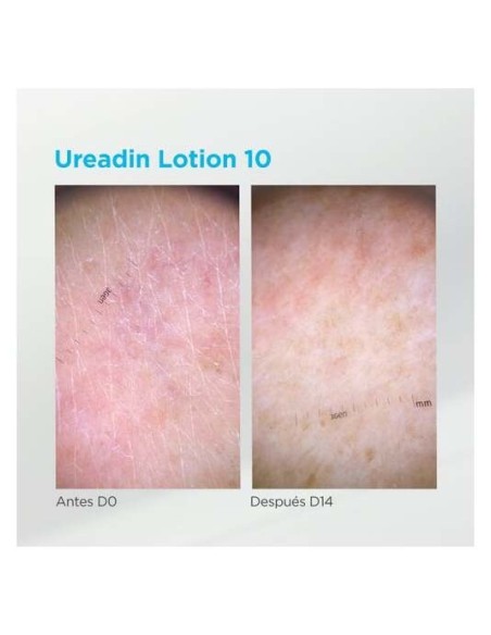 Isdin Ureadin 10 Lotion Hidratación Intensa Piel Seca, 1000 Ml