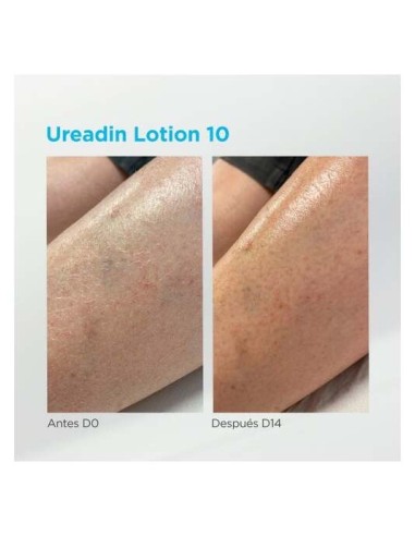 Isdin Ureadin 10 Lotion Hidratación Intensa Piel Seca, 1000 Ml